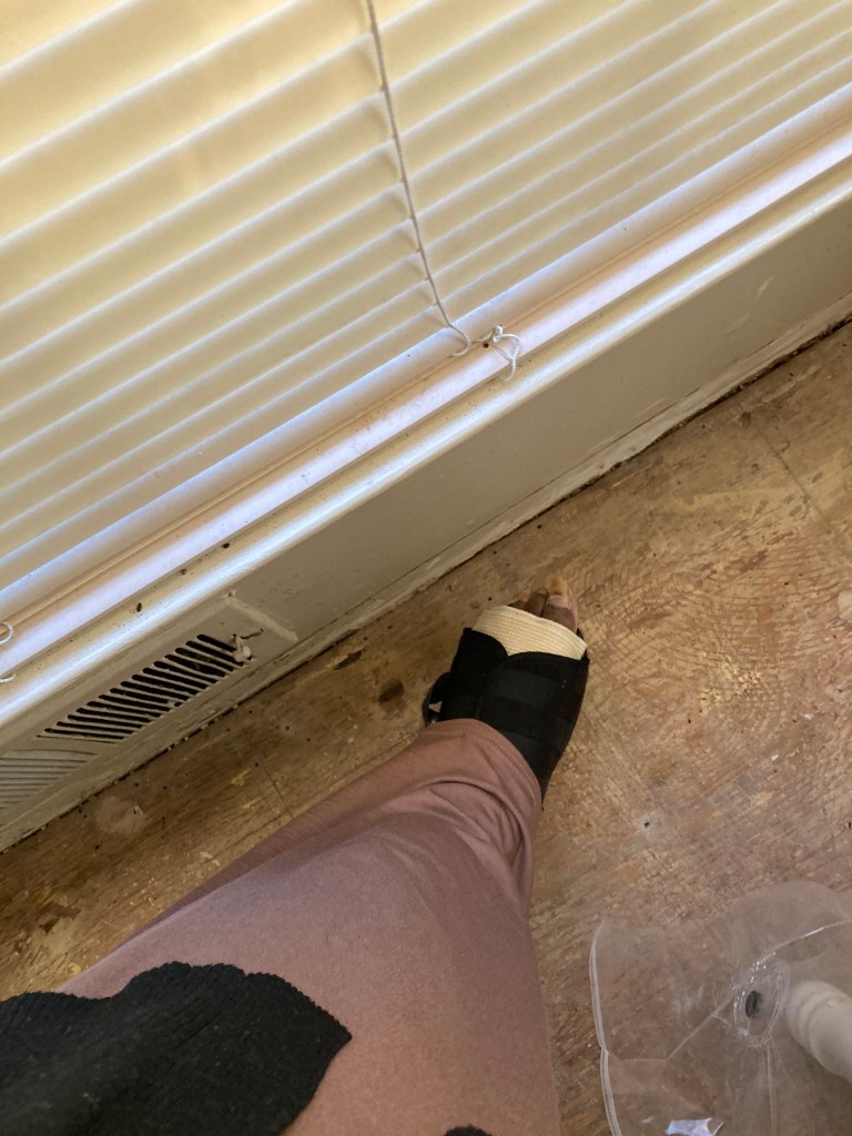 Left foot Fahmeena Odetta Moore