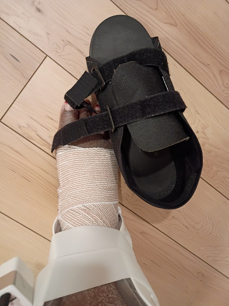 Wrapped foot with boot